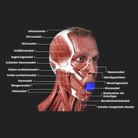 Thumbnail for Grafik eines männlichen Gesichts mit sichtbaren Gesichtsmuskeln und blauem Kinntrainer im Mund